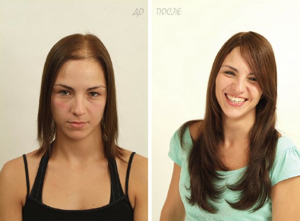 Почему 1000 девушек уже выбрали систему волос?